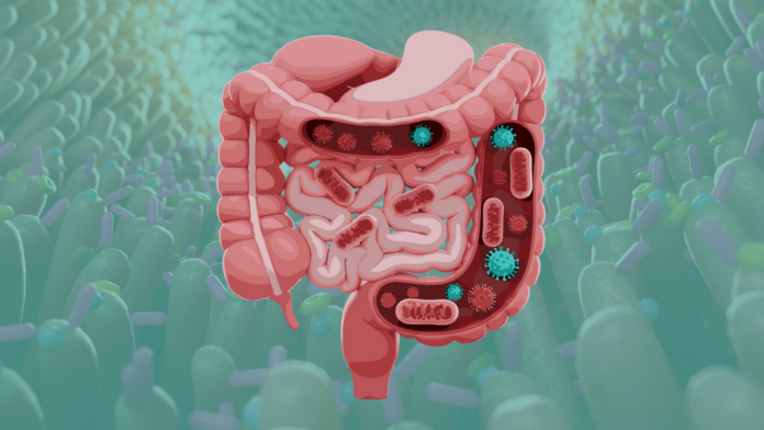 GutOptim is a Natural Solution